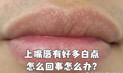 肺部肿瘤恶性化疗期间可以吃饭吗-肺部肿瘤恶性化疗期间可以吃饭网肺部肿瘤恶性化疗期间可以吃饭吗知识网站,分享肺部肿瘤做化疗能活多久大全